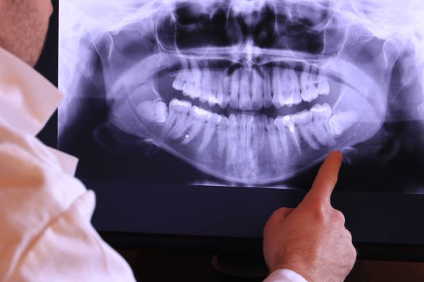 Best Chipped Tooth Repair Near Me  in Mford, IL